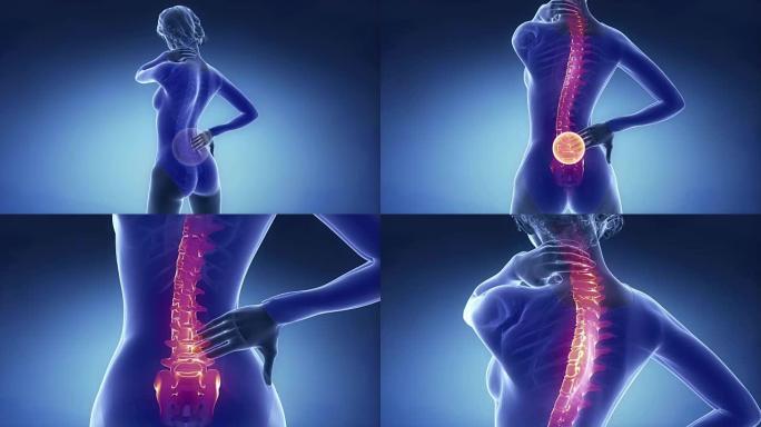 女性脊柱损伤疼痛-脊柱损伤概念