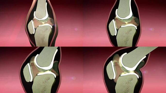 3d渲染膝盖插图