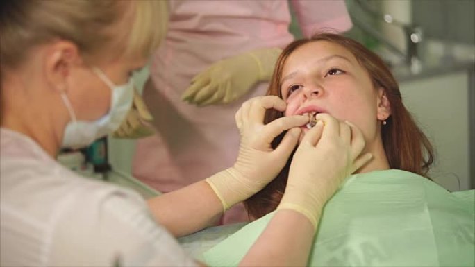 牙科充填的过程。现代牙齿治疗方法