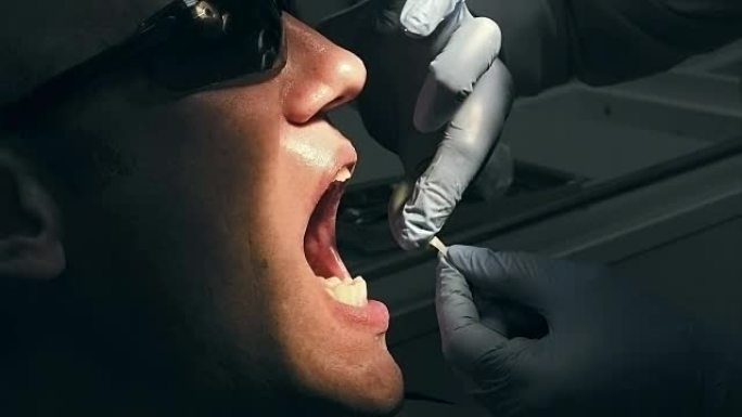 中年男子获得医疗牙齿去除牙结石