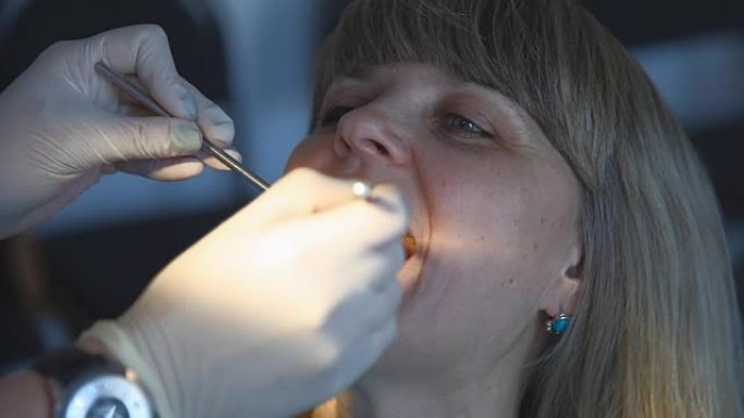 牙医检查一个女人的蛀牙。