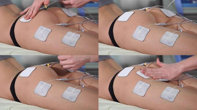女人接受电刺激治疗的屁股。