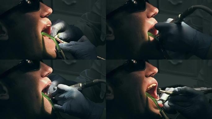 中年男子获得医疗牙齿去除牙结石