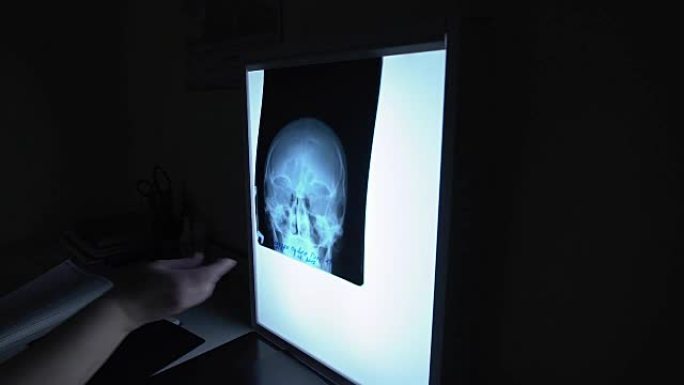 在医疗诊所中关闭医生的手，在显示屏上拍摄x射线，以识别患者的伤害。带有头部伦根扫描的灯板固定在桌子上