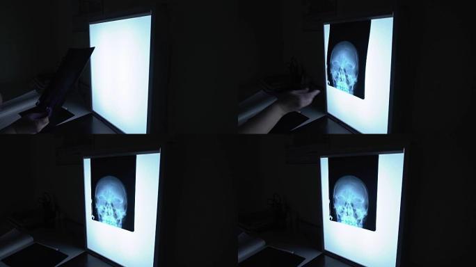 在医疗诊所中关闭医生的手，在显示屏上拍摄x射线，以识别患者的伤害。带有头部伦根扫描的灯板固定在桌子上