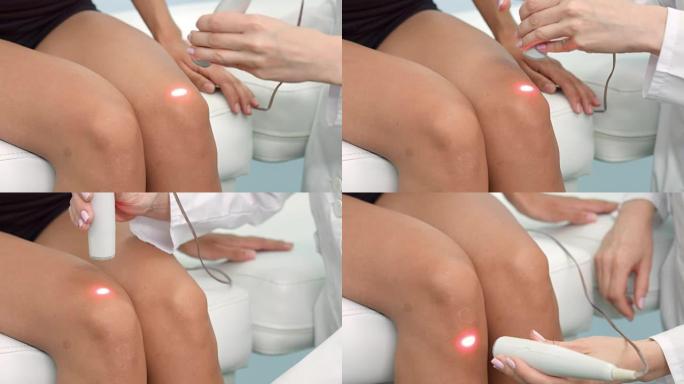 膝关节的激光疗法治疗。