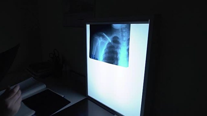 医生看了x光。图像显示锁骨，肋骨和肺。用骨中的支架愈合骨折的过程。黑暗的房间