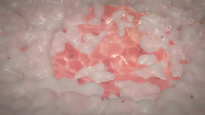 胃溃疡的3D动画，4k超高清。