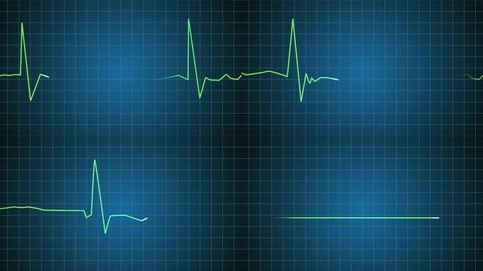 死亡: EKG心脏监护仪变平 (4K)