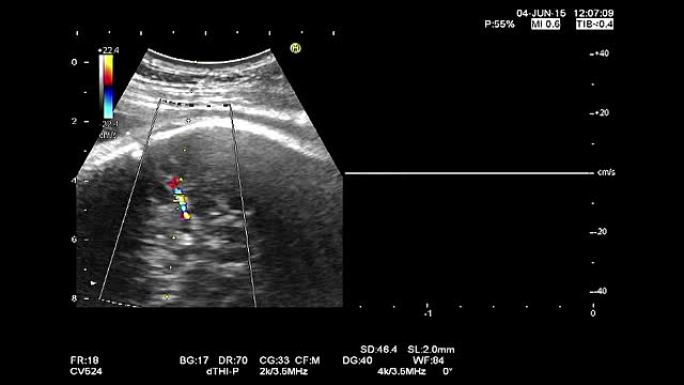 高质量超声回波检查。妇科医学检查。33周龄妊娠胎儿心跳记录