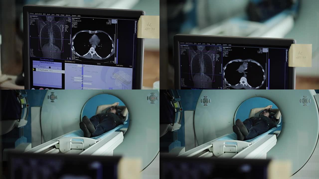 患者胸部三维模型的CT重建