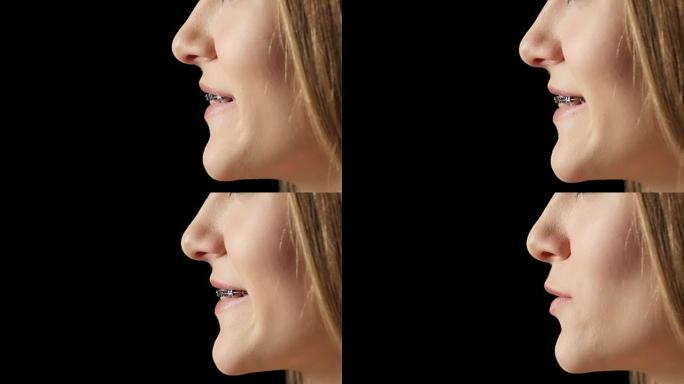 带背带微笑的侧写女孩。黑色