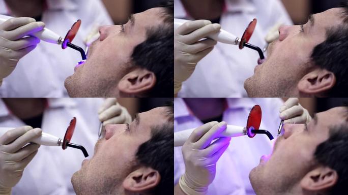 牙医在口腔中使用牙科聚合灯。