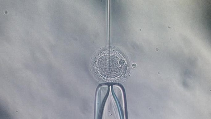 卵胞浆内单精子注射IVF ICSI细胞实验