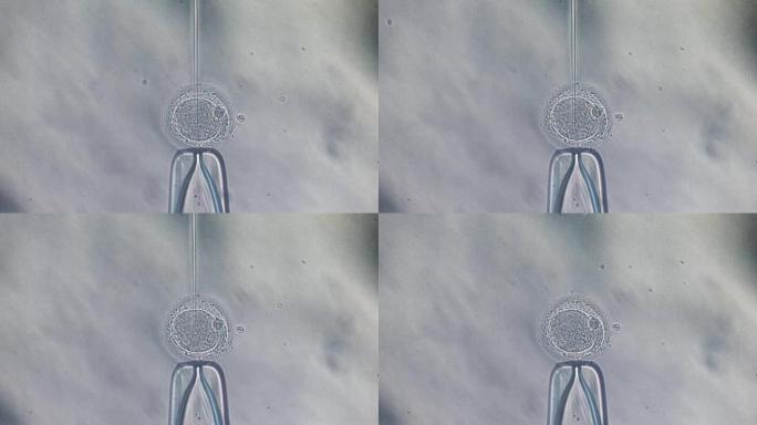 卵胞浆内单精子注射IVF ICSI细胞实验