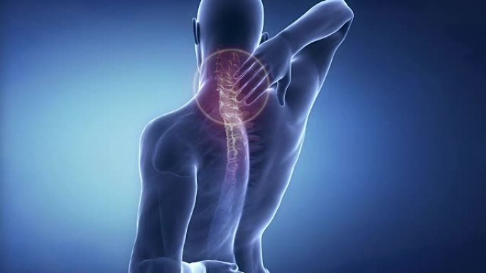 男性颈椎脊柱疼痛-脊柱疼痛概念