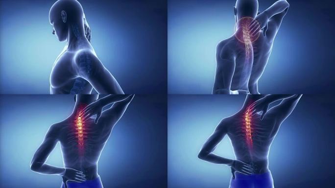男性颈椎脊柱疼痛-脊柱疼痛概念