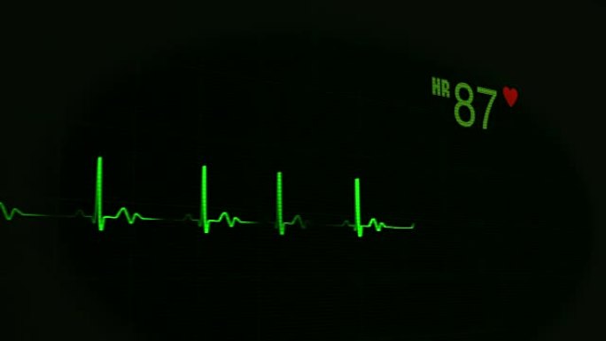 绿色不间断线的心跳脉搏