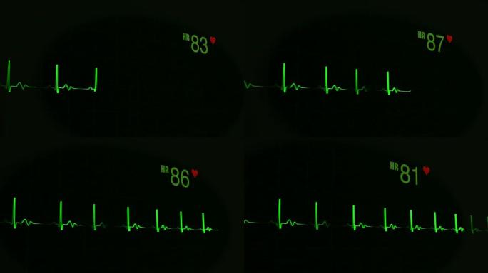 绿色不间断线的心跳脉搏