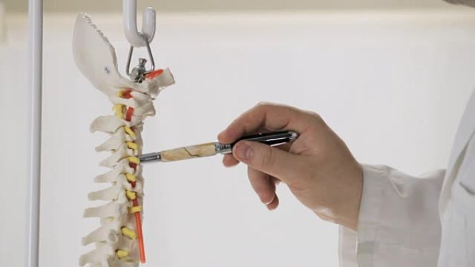 医生展示了人类椎骨的石膏模型