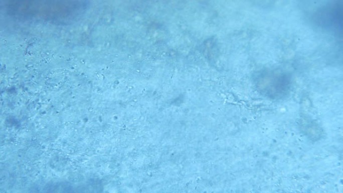 显微镜下的精子