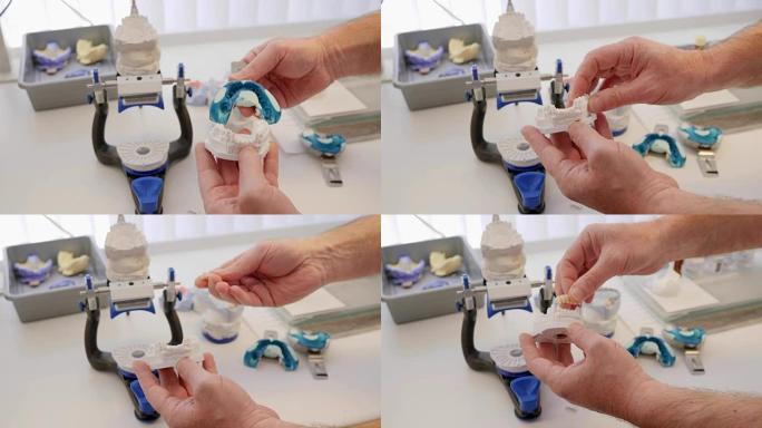 牙齿矫正，牙医用白色和蓝色的特殊塑料制成假肢的牙齿