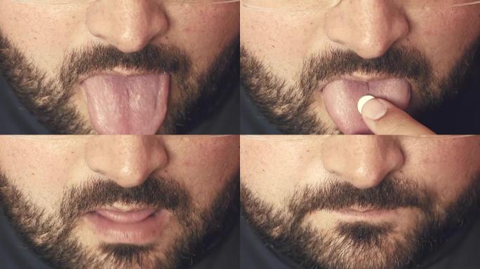 男人张开嘴在舌头上吃药丸、药片或药物。止痛药治疗或联用麻醉