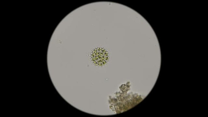 显微镜下硅藻的美丽图案