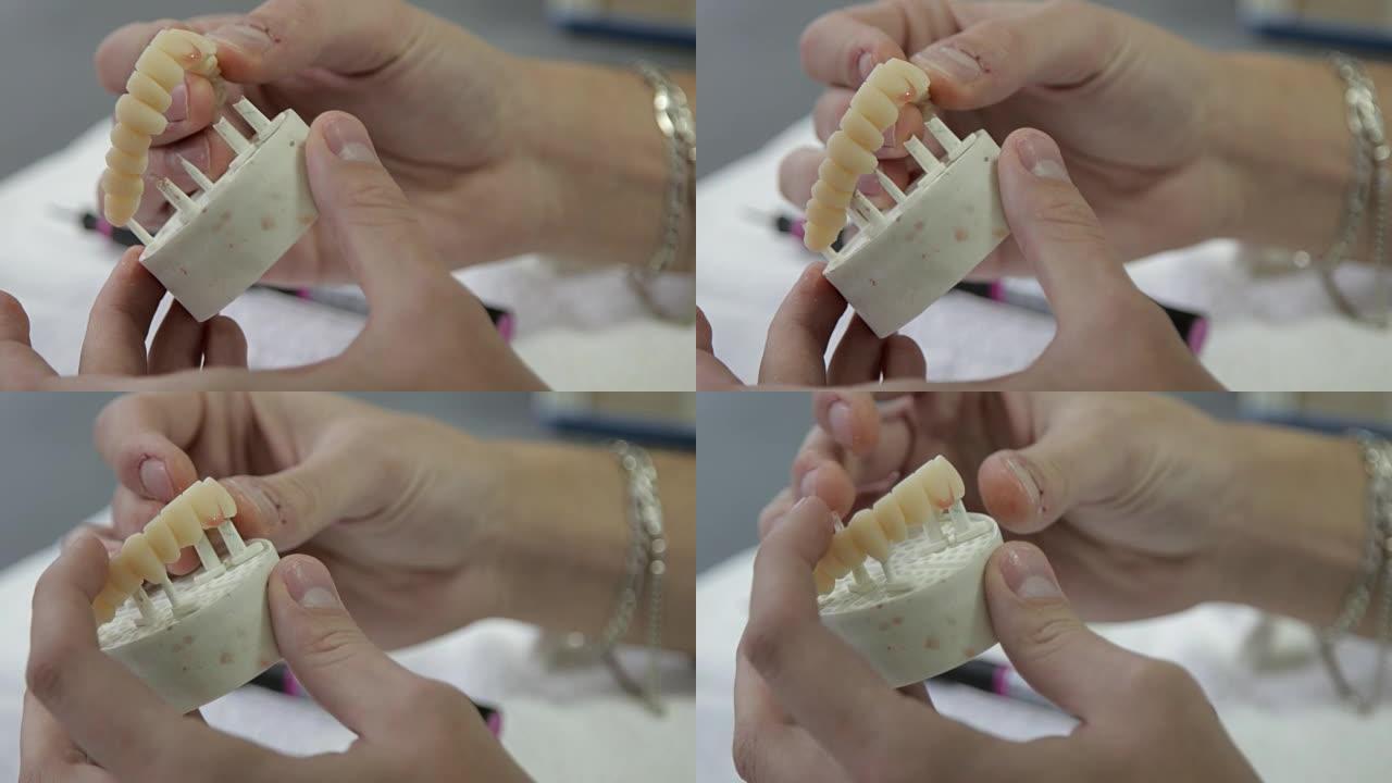 牙科技师将升级后的3D模型放在支架上