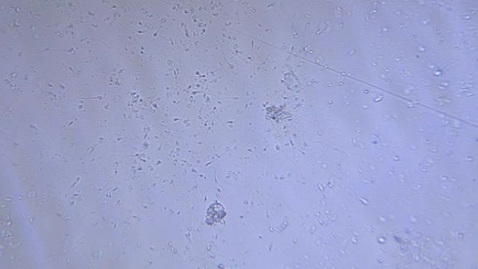 显微镜下的精液