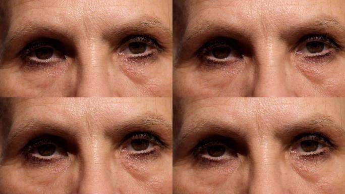 55岁后女人的疲倦眼睛