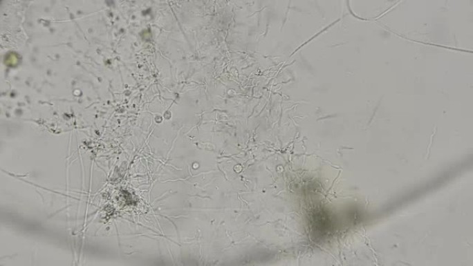 显微镜下细菌螺旋体的菌落