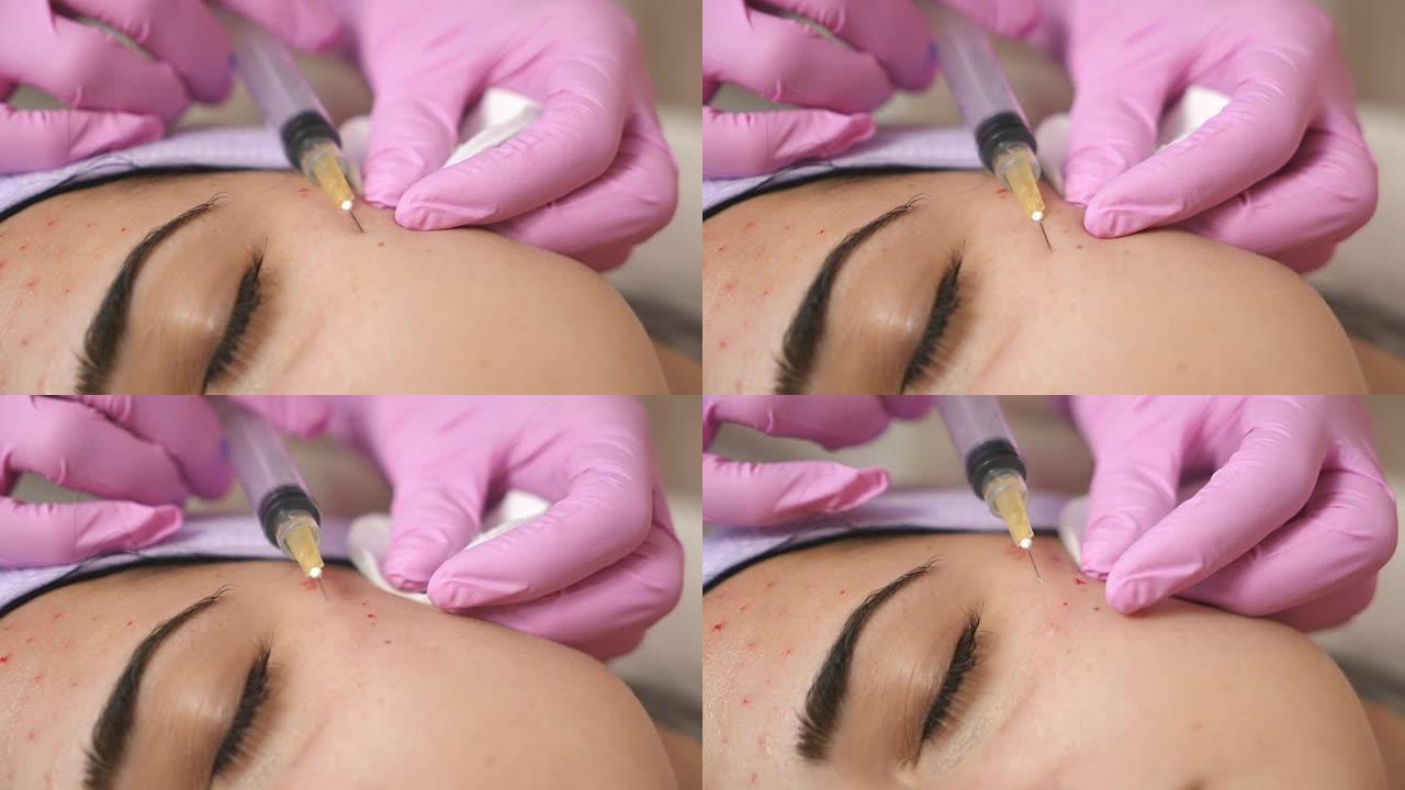 医生美容师制造肉毒杆菌毒素注射。收紧和抚平皱纹的程序。恢复活力的面部注射。