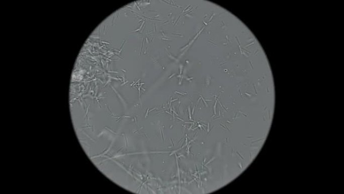 细菌菌落-显微镜下的尸体手指