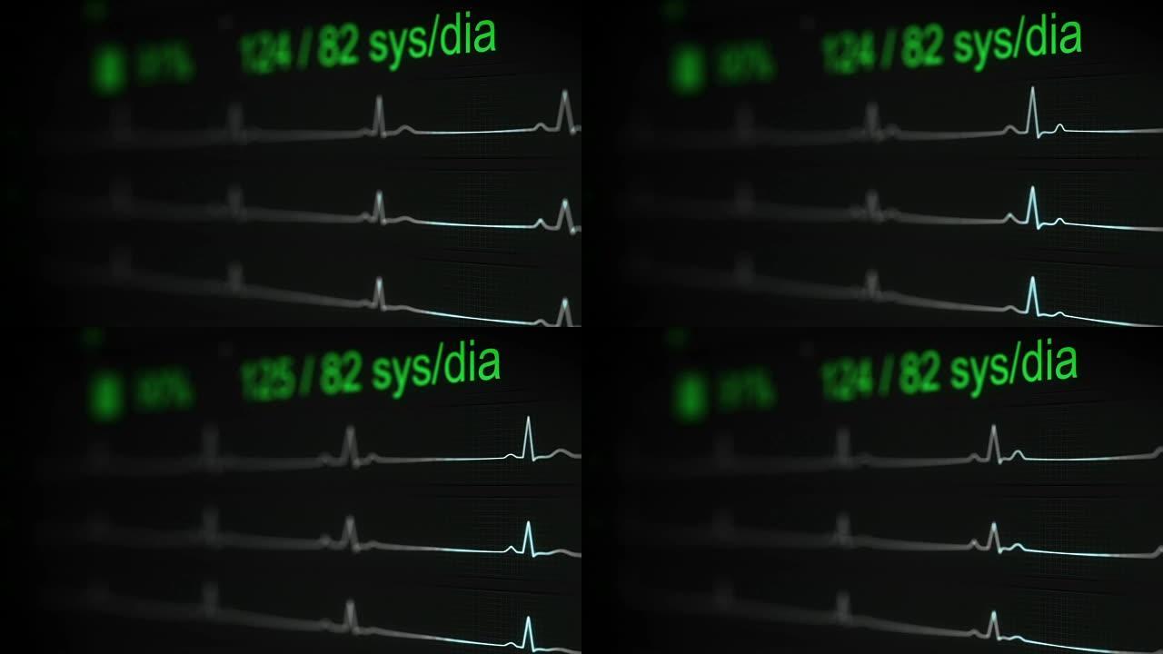 带dop的心电测试医学概念无缝循环动画