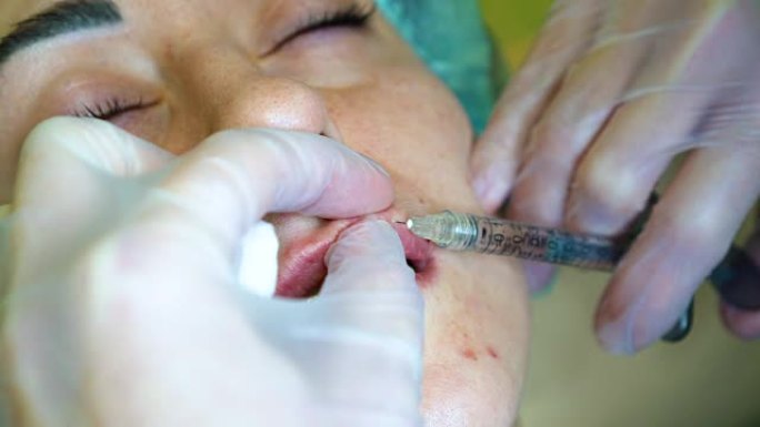 美容师制作注射塑料嘴唇。诊所的年轻女子嘴唇增大