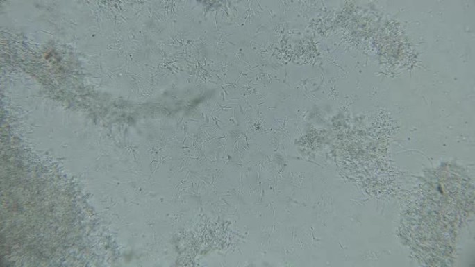 细菌菌落-显微镜下的尸体手指