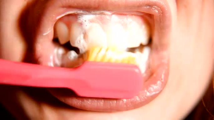 牙刷清洁牙齿