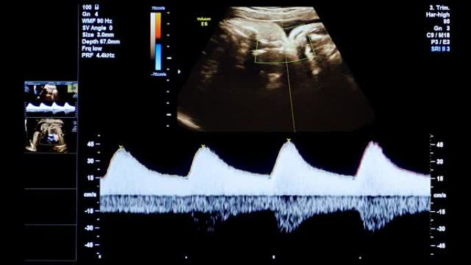 高清医学超声扫描。心率诊断