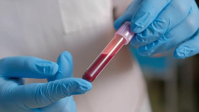 女实验室技术人员戴着防护手套，拿着移液器，在医院病房中测试血液样本是否输血，双手合十。试管。血液采样