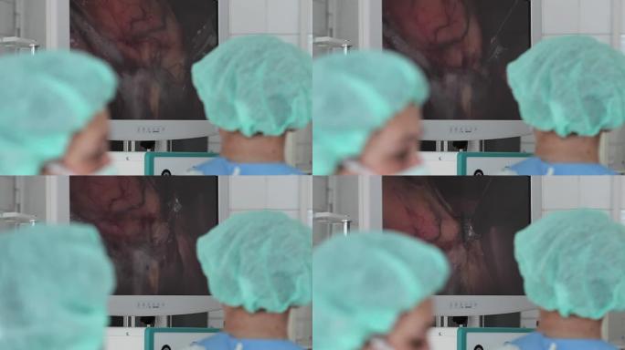 外科医生和助手通过监视器进行手术。