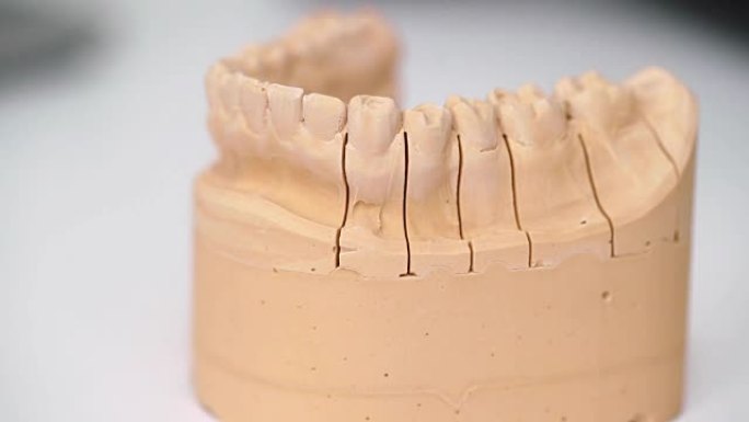 牙科诊所的颌骨模型