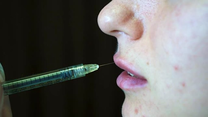 美容师制作注射塑料嘴唇。诊所的年轻女子嘴唇增大