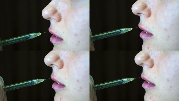 美容师制作注射塑料嘴唇。诊所的年轻女子嘴唇增大