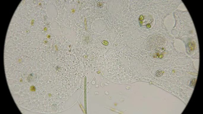 在显微镜下在死去的婴儿中形成微生物的菌落