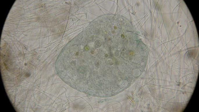 显微镜下的infusoria Stentor蓝斑