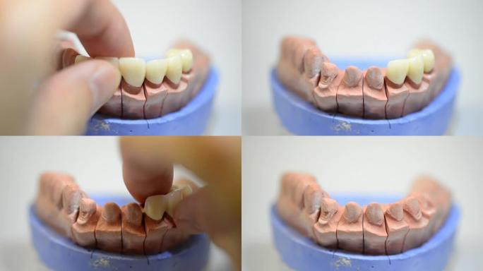 在实验室中从事3D打印模具的牙科技术人员