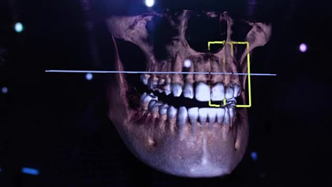 3D牙科数字建模修复。3d牙齿模型，患者的牙齿扫描。医生正在研究牙齿。