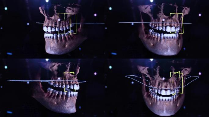 3D牙科数字建模修复。3d牙齿模型，患者的牙齿扫描。医生正在研究牙齿。