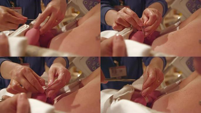医院妈妈腿上的一个新生婴儿戴上了名牌